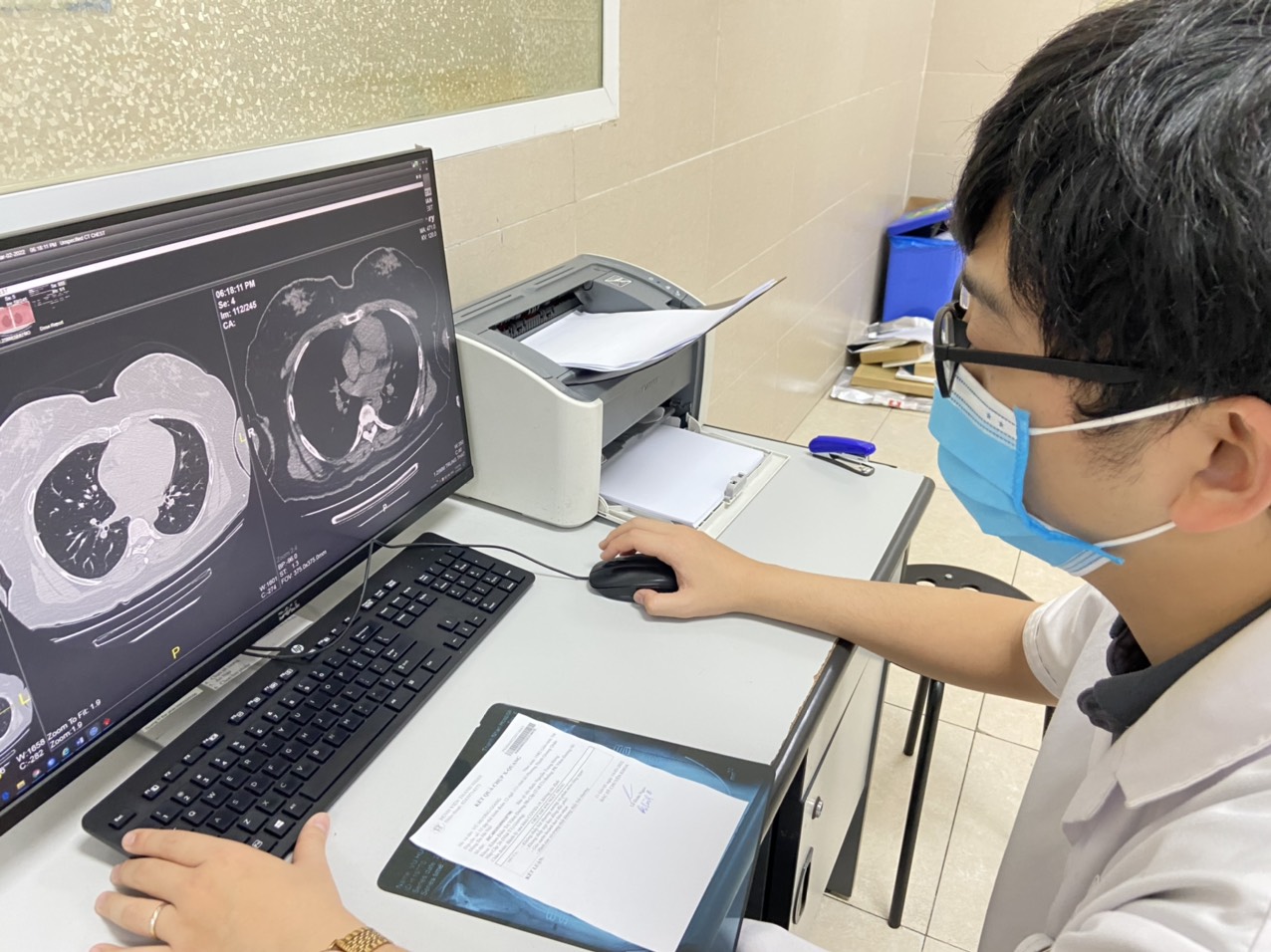   F0 uống kháng sinh phòng bội nhiễm phổi có nên hay không?